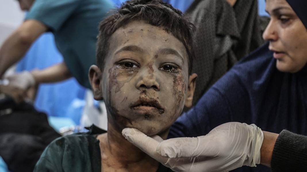 Gazze kan ağlıyor... Savaşın on beşinci gününde kahreden görüntüler 1